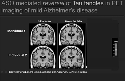 "Designer DNA Drug" Therapy for Neurodegenerative Disease